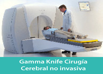 Gamma Knife Cirugía Cerebral no Invasiva